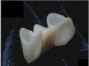 Full Dental Products