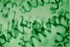 Bule-Green Algae (Spir...