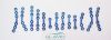 Maxillofacial Bone Implant Plates