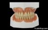 Full Dentures