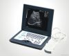 Laptop Ultrasound Scan...