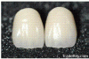 Enjoy Denture