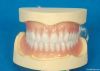 Dental acrylic removab...