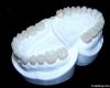 Dental zircon PFM porc...
