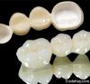 Dental zircon PFM porc...