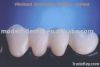 Dental zirconia PFM po...