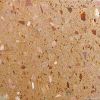 QuartzStone(Multi color)Quartz slabs, Quartz Tiles, Quartz Countertop