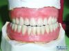 Dental Half/ Full mout...