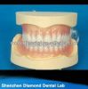 Dental partial removab...