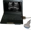 UBook-7 Ultrasound B scanner(Notebook)