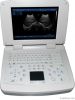 SS-10 Laptop PC Basic Ultrasound Scanner(3D image optional)