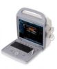 Laptop-sized Color Doppler System