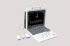 TH-5100 Portable Cardiac Color Doppler