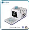 Portabe B/W Ultrasound Machine with Multi-Frequency Convex Probe