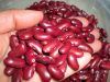 Red Kidney Beans | Black Kidney Beans Hot sales