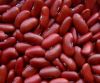 Grade 1 Kidney Beans 