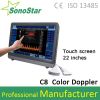 C8 Portable Touch Screen Color Doppler Ultrasound System