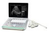 SS-7 Laptop Ultrasound...