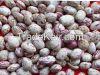 KIDNEY bean, Long Shape Kidney Bean, Round Shape Kidney Bean
