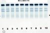 PROTEIN ELECTROPHORESIS (PE)