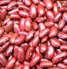 Red,Black and White Kidney Beans 