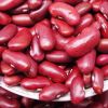 Red,Black and White Kidney Beans 