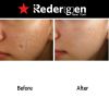 [Redergen] Face Brightening Cream, Whitening Cream, No.1 Aesthetic, Professional, Face, Age Spots, 50g