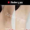 [Redergen]Miracle Axilla Underarm, Armpit Brightening Bleaching Whitening Cream, No.1 Aesthetic, Professional, 50g