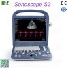 Factory direct sales ecografo sonoscape s2 price lis