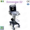 Factory direct sales ecografo sonoscape s2 price lis