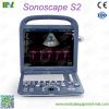 Factory direct sales ecografo sonoscape s2 price lis