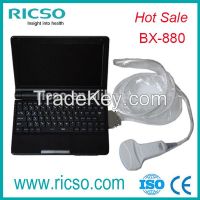 Best Cheapest USB Portable Ultrasound Scanner Machine Price For Pregnancy