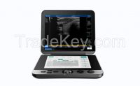 Portable ultrasound scanner