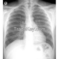 Drystar 8x 10" medical x-ray dry film original in Belgium