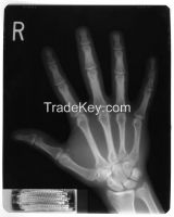 Drystar 10x12" medical x-ray dry film original in Belgium