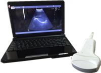 10.1" TFT LED Ultrasound Scanner with Convex Linear Transvaginal Micro Convex Probe