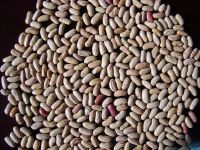 Light Speckled Kidney Beans(LSKB)