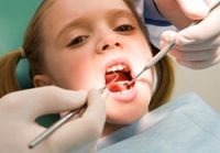 Dental Hospitals in Attapur, Laser Dental Clinic in Hyderabad, Child Dental Care-Shinensmile.com