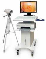 Trolley Video Colposcope