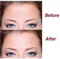 Lifting Up Brow Beauty Moisturizing Forehead Anti-Wrinkle Patch 