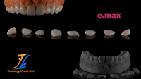 Dental emax  ceramic veneers dental supplies