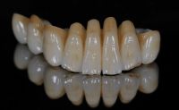 Zirconia crown/bridge/denture/dental restorations/dental supplies