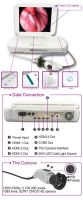 YKD-9003A2 Portable medical endoscope for ENT with cold light LED source 35W