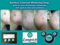 Longrich Bamboo Charcoal Soap-Scar removal, Stress marks, Beauty soap, Face Clear, Pimples off, Dark sports, Body Wash.  From China