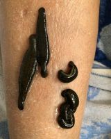  Live leeches for Medical Use Only