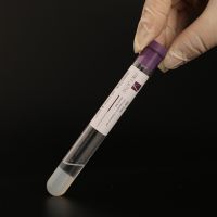 Sodium citrate gel Platelet Rich Plasma PRP Tube with Gel