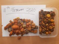 Gallstones