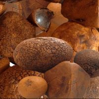 Gall Stones