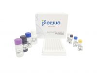 Human Anti-immunodeficiency Virus Antibody,HIV