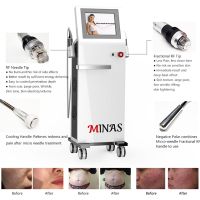 Rf Microneedling Machine Microneedle Rf Skin Tightening Machine Rf Microneedle Fractional